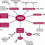 Causes of irritable bowel syndrome
