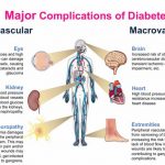 Complications of diabetes