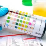 Everything That You Need To Know About Urine Drug Screening